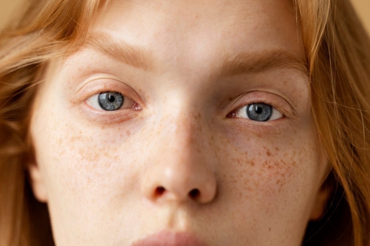 Πανάδες - Μέλασμα, τι είναι και πως αντιμετωπίζονται