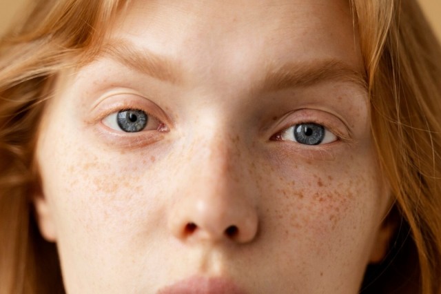 Πανάδες - Μέλασμα, τι είναι και πως αντιμετωπίζονται