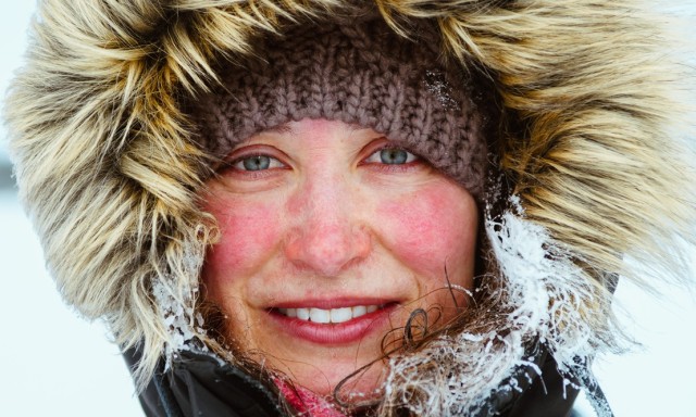 Ξηροδερμία τον χειμώνα, πώς να προστατέψετε το δέρμα σας